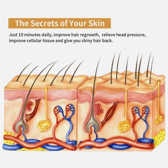 Creation Of Beauty RF & Laser Hair Regrowth Comb (Rechargeable) - Picture 8 of 9